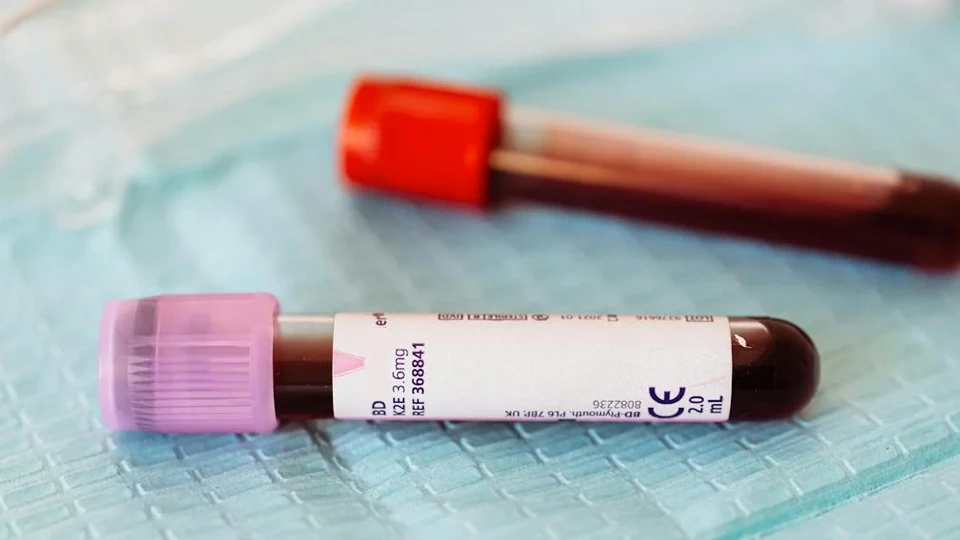 Профессия &laquo;Профессия трансфузиолог&raquo;